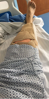 Saina-knee-surgery