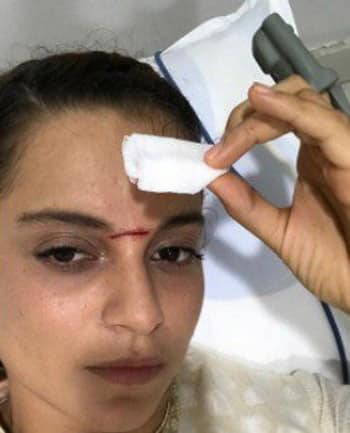 Kangana Ranaut badly Injured on the sets of Manikarnika