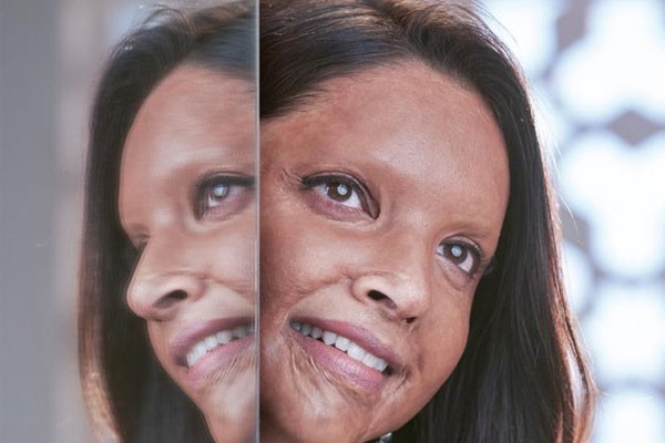 First Look Deepika Padukone surprises as acid attack survivor