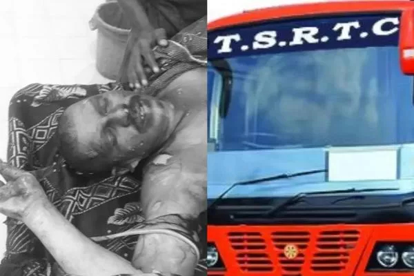 Telangana RTC driver who attempted self-immolation dies