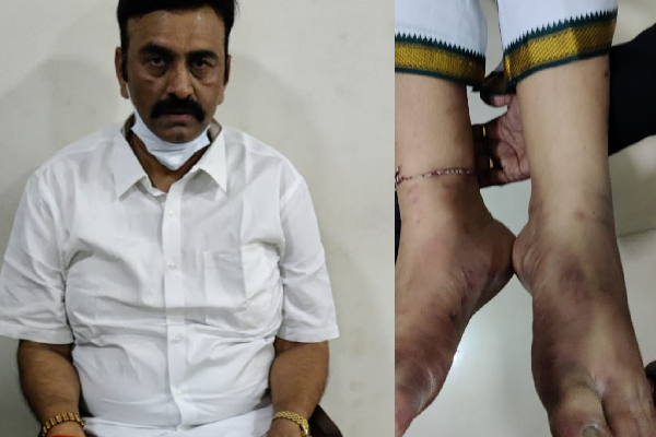 ‘Plaster of paris’ bandage to Raju feet at Delhi AIIMS