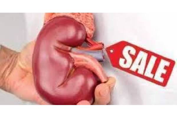 Kidney Sale